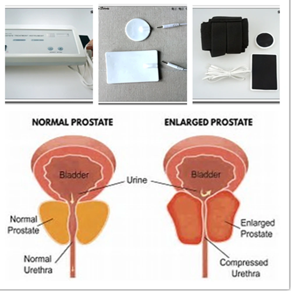 Powerful Prostate Massager Pul - Therapy Health And Wellness review and price